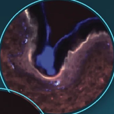 Microscope images of skin tissue with magnesium ions shown in blue